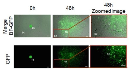 Measure Migration Monitoring Cell Outgrowth from a GFP-labeled HUVEC Spheroid