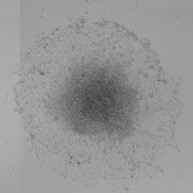 Measure Migration onto Extracellular Matrix Spheroid Brightfield image-2