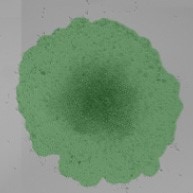 Measure Migration onto Extracellular Matrix Spheroid Brightfield image-3