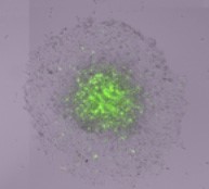 Measure Migration onto Extracellular Matrix Spheroid Brightfield image-5