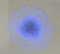 Measure Migration onto Extracellular Matrix Spheroid Brightfield image-4