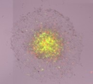 Measure Migration onto Extracellular Matrix Spheroid Brightfield image-7