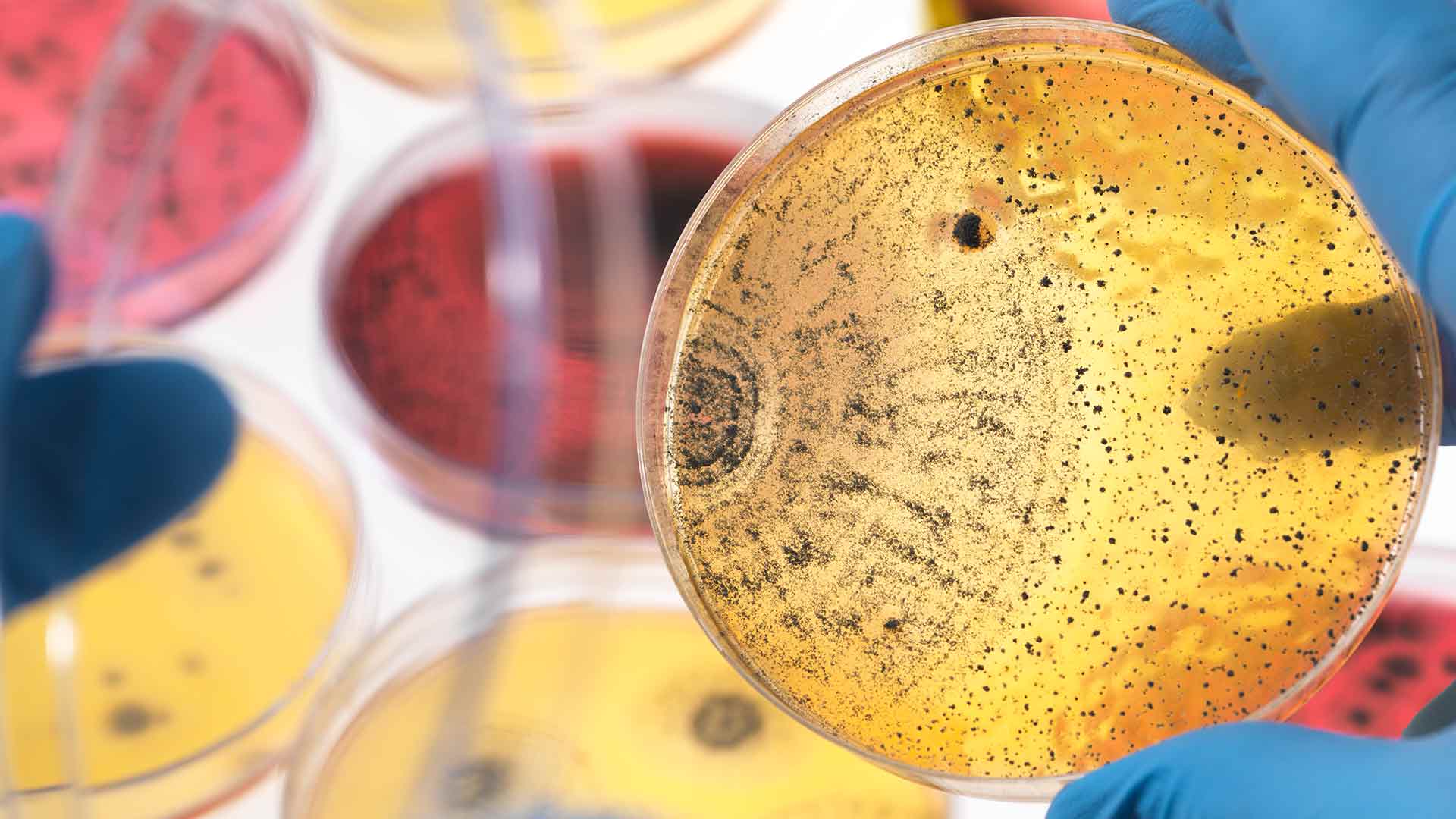 metagenomic microbiome microbes petridish laboratory thumbnail