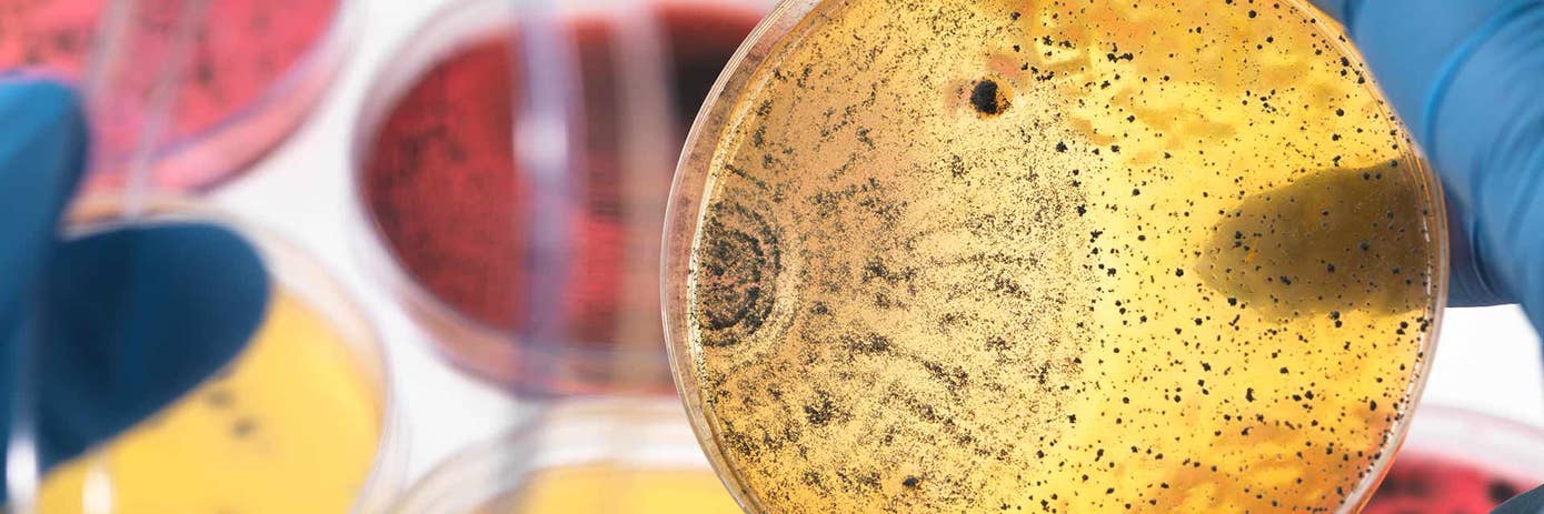 metagenomic microbiome microbes petridish laboratory hero