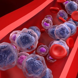 Mimix Myeloid Cancer gDNA IVD