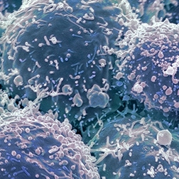 mimix non small cell lung cancer panel thumbnail