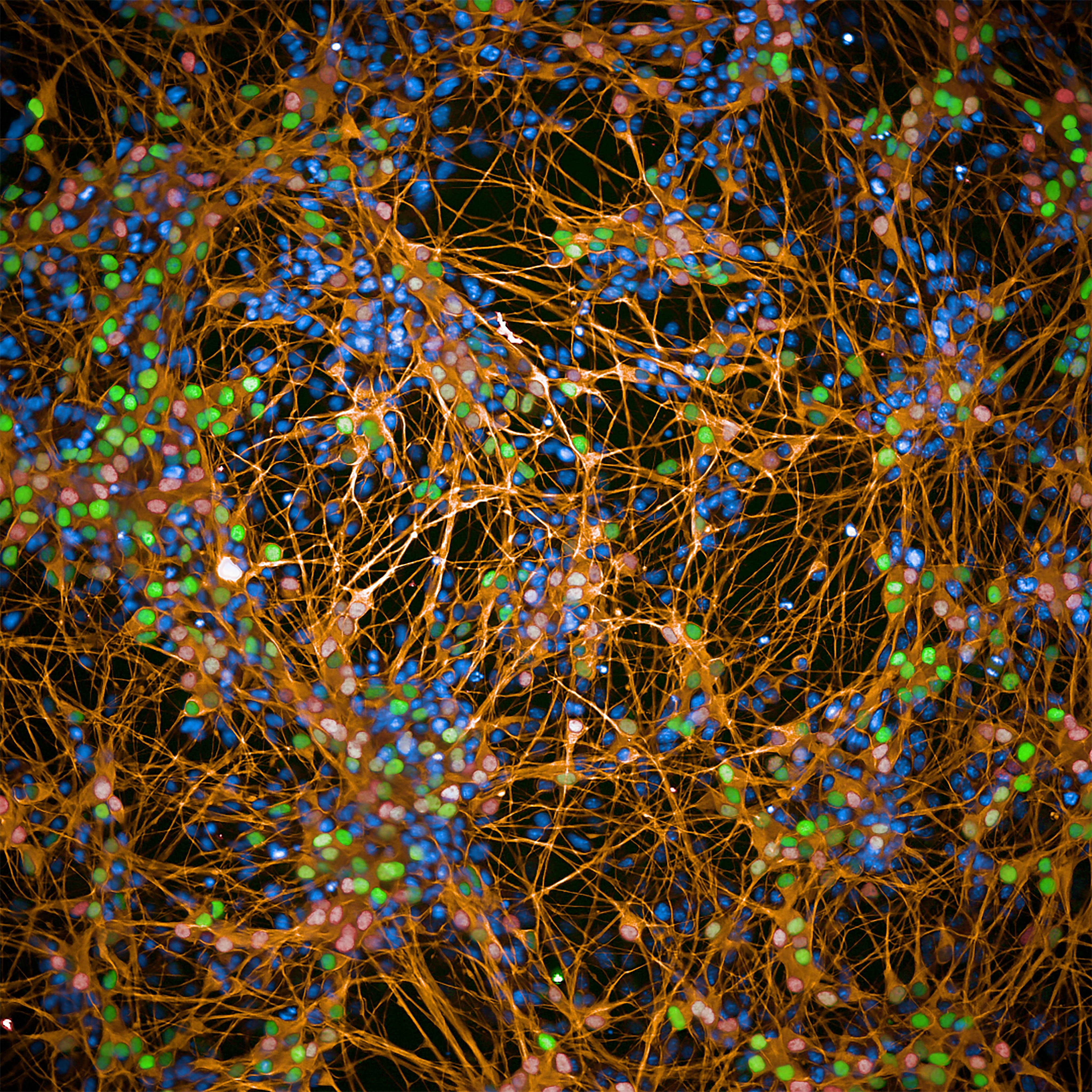 iPSC-derived motor neurons imaged on the Operetta CLS high-content analysis system.