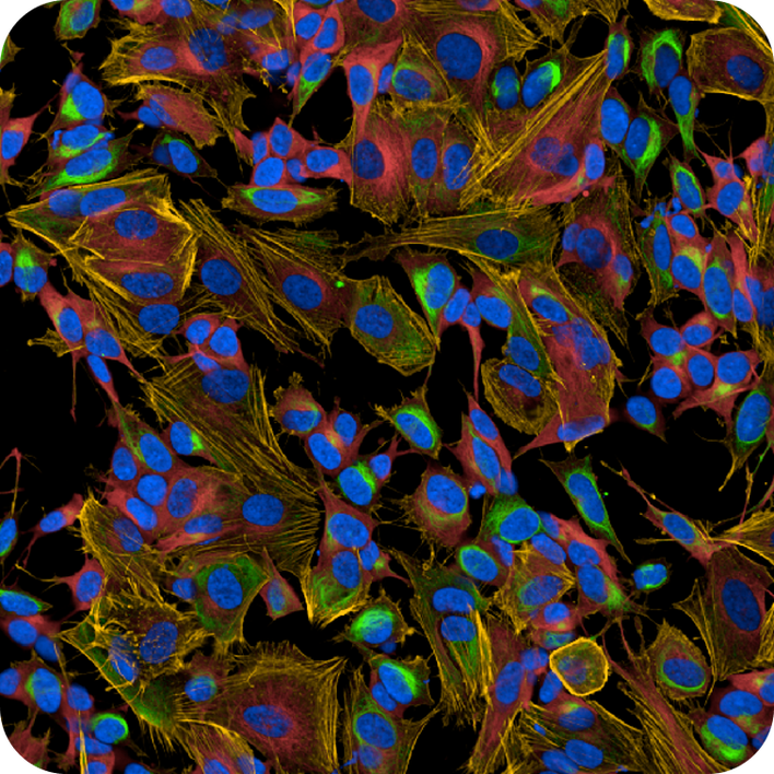 Neuroblastoma SHSY5Y cells imaged on the Opera Phenix Plus high-content screening system.