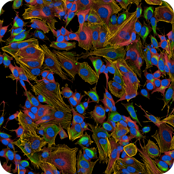 Neuroblastoma SHSY5Y cells imaged on the Opera Phenix Plus high-content screening system.