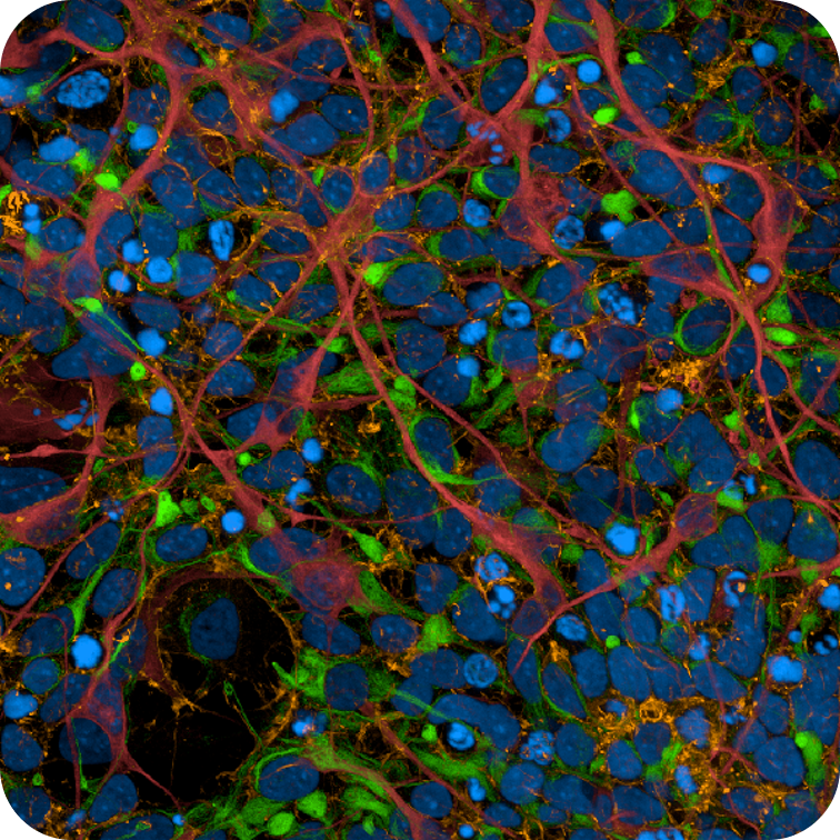 iPSC-derived human cortical neurons imaged on the Operetta CLS high-content analysis system.