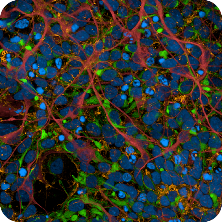 iPSC-derived human cortical neurons imaged on the Operetta CLS high-content analysis system.