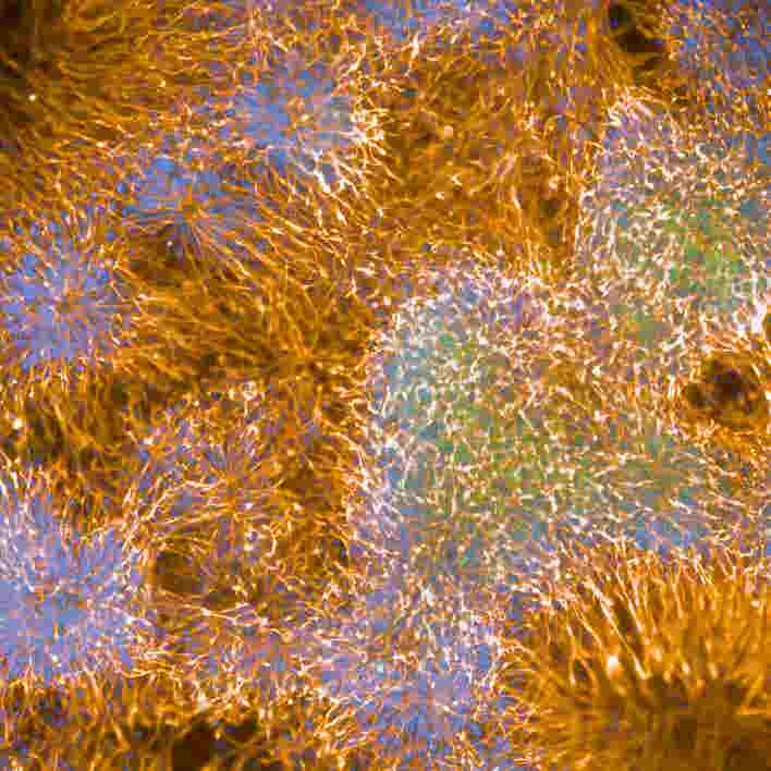 Neurons imaged on the Operetta CLS high-content analysis system.