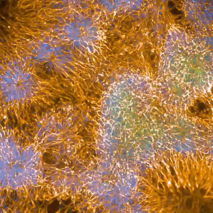 Neurons imaged on the Operetta CLS high-content analysis system.