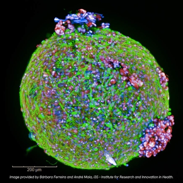 img-organoid-derived872x872