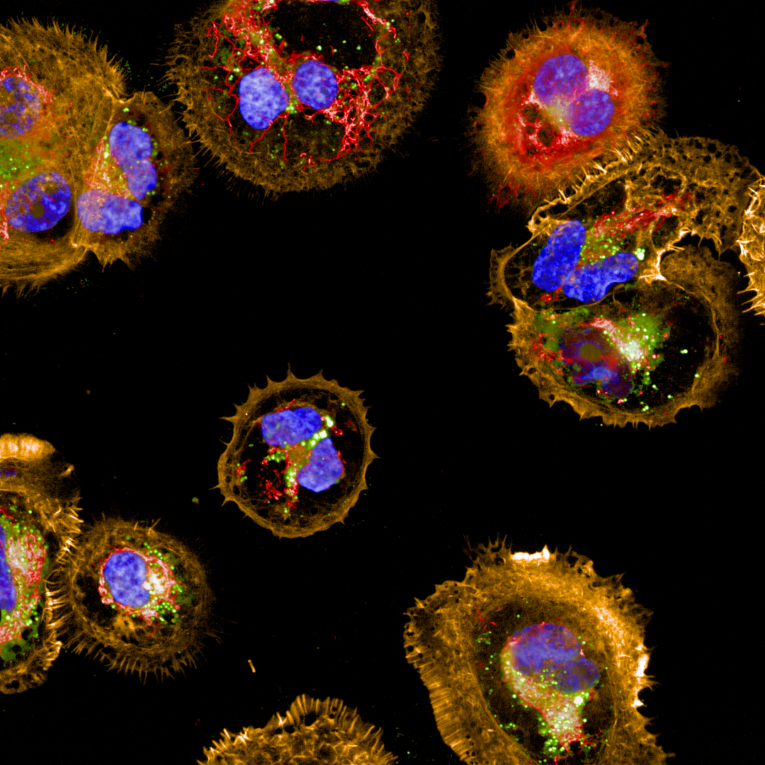 "Human ovarian granulosa tumor cell line imaged on the Operetta CLS high-content analysis system. "