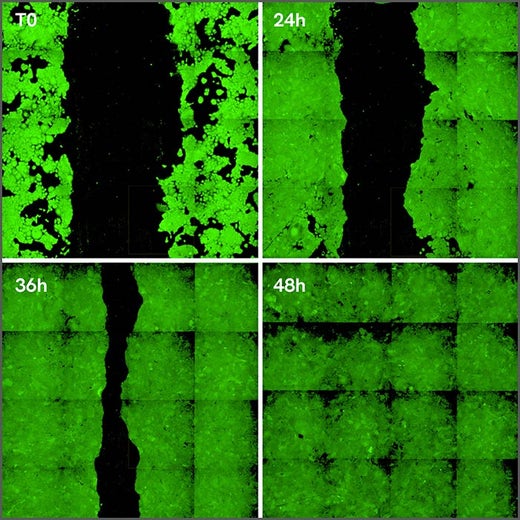 HaCaT cells stained with PhenoVue 492 live cell tracer to monitor wound healing.