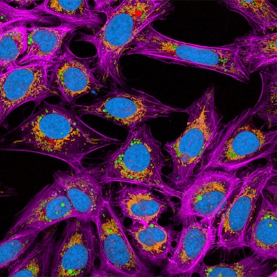 PhenoVue anti-TOM20 antibody primary image