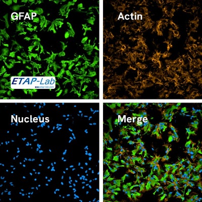 iPSC-derived human astrocytes from ETAP-Lab stained with PhenoVue astrocyte differentiation staining kit.
