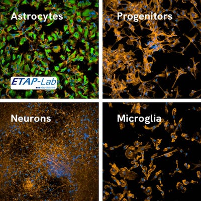 iPSC-derived human astrocytes (ETAP-Lab), progenitors, neurons and microglia stained with PhenoVue astrocyte differentiation staining kit. GFAP in green, actin in orange, nucleus in blue.