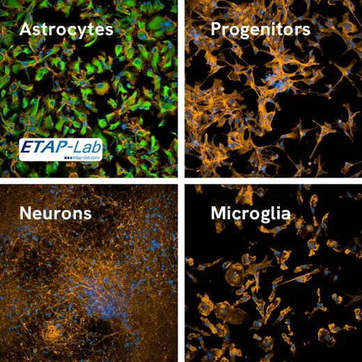 iPSC-derived human astrocytes (ETAP-Lab), progenitors, neurons and microglia stained with PhenoVue astrocyte differentiation staining kit. GFAP in green, actin in orange, nucleus in blue.