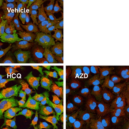 Hydroxychloroquine or AZD- treated HeLa cells stained with the PhenoVue autophagy staining kit.