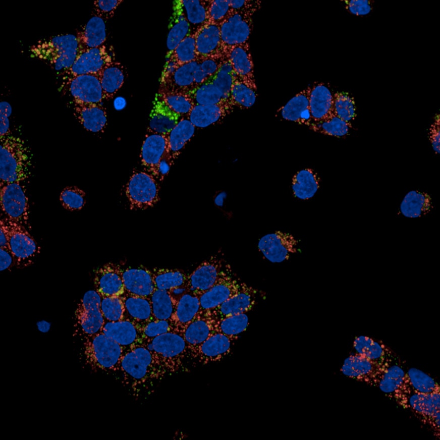 BT-474 cells showing Trastuzumab internalization using the PhenoVue human IgG antibody internalization kit (Fluor 647, pH-sensitive): nuclei (blue), lysosomes (green), and pH-sensitive Fab–Trastuzumab complex (red).