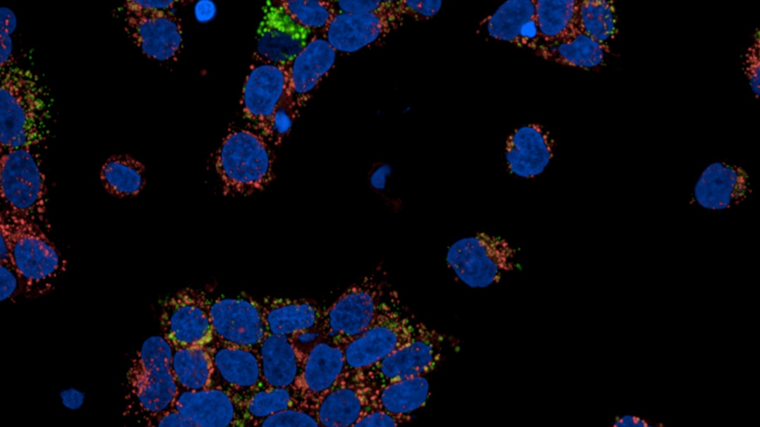 BT-474 cells showing Trastuzumab internalization using the PhenoVue human IgG antibody internalization kit (Fluor 647, pH-sensitive): nuclei (blue), lysosomes (green), and pH-sensitive Fab–Trastuzumab complex (red).