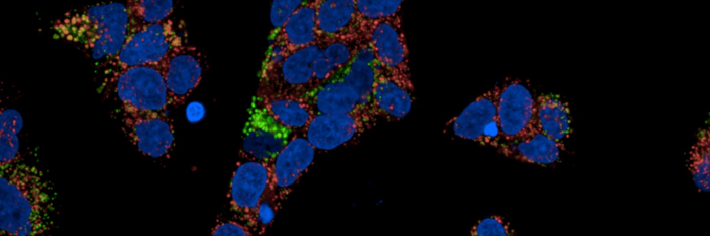 phenovue internalization hero