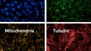 phenovue live cell painting kit image1