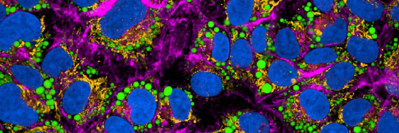 phenovue r n d video