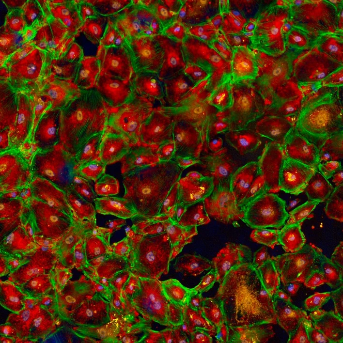 Immortalized human podocytes imaged on the Opera Phenix Plus high-content screening system.