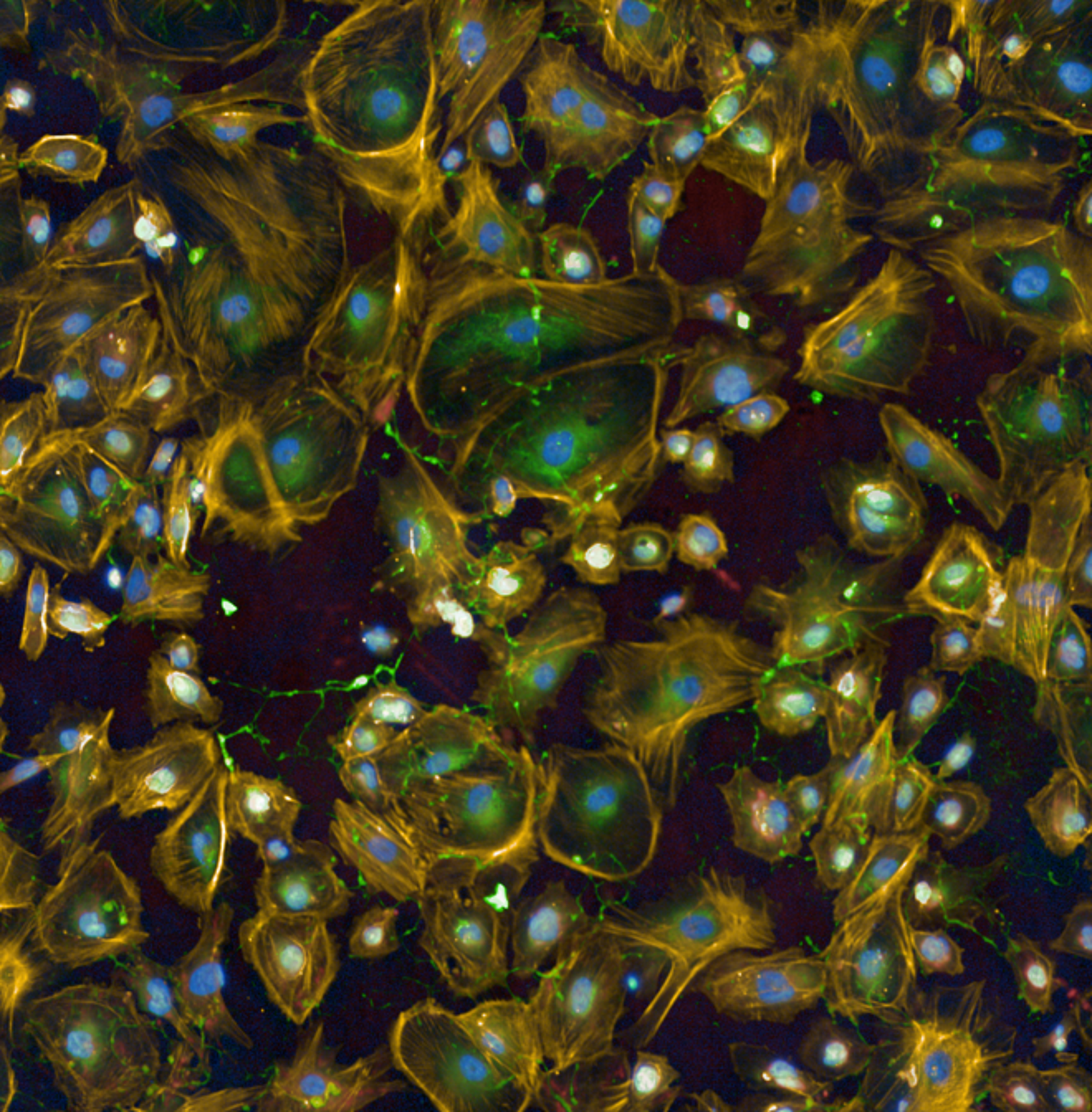 Immortalized human podocytes imaged on the Opera Phenix Plus high-content screening system.