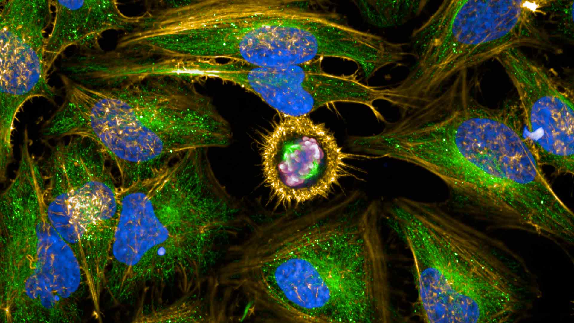 High-content conversations: Professor Luca Magnani, at the Institute of Cancer Research, London.