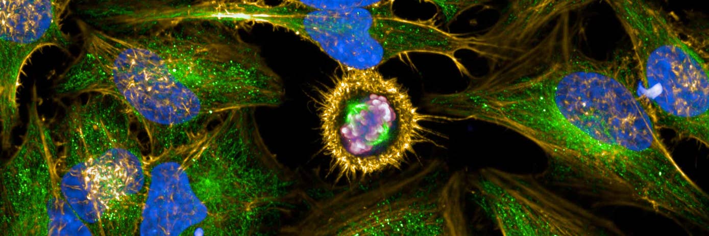 High-content conversations: Professor Luca Magnani, at the Institute of Cancer Research, London.