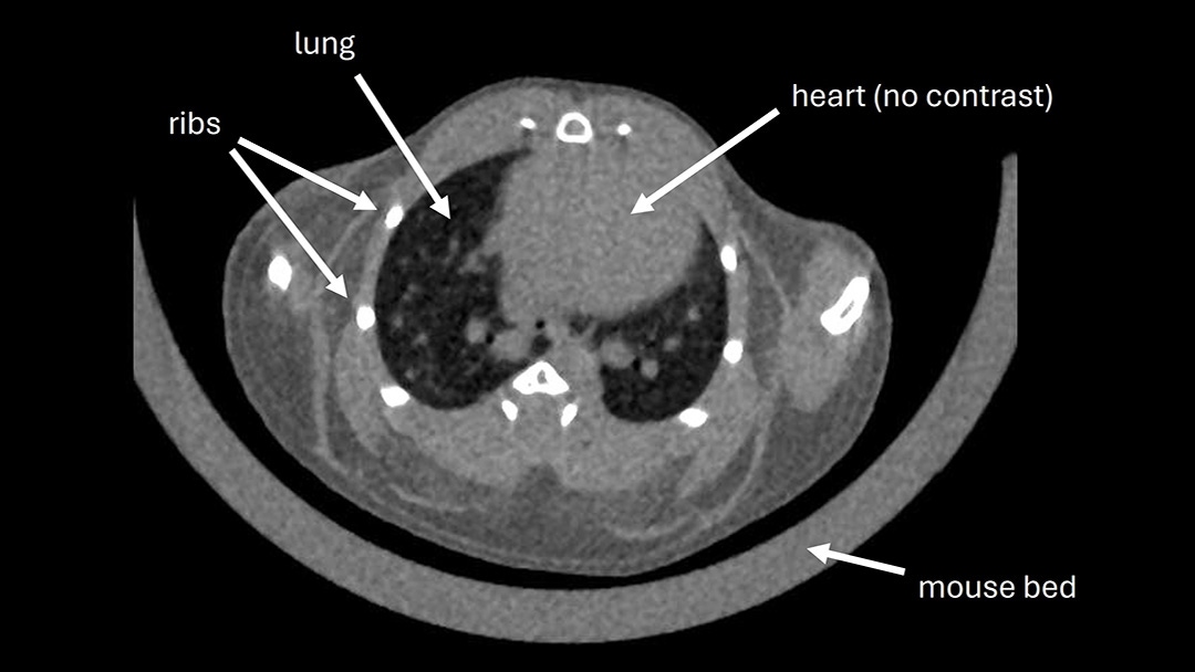 Retrospective respiratory-gated scan