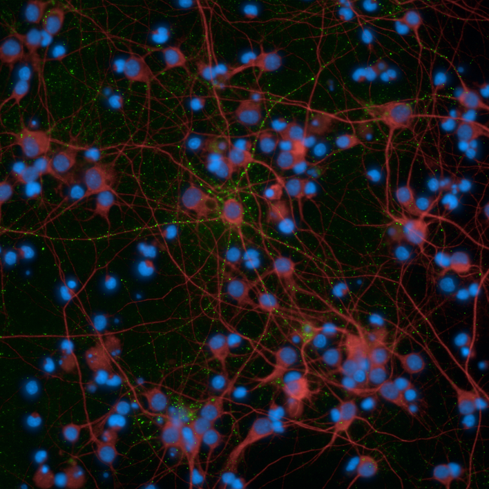 Primary rat neurons imaged on the Operetta CLS high-content analysis system.