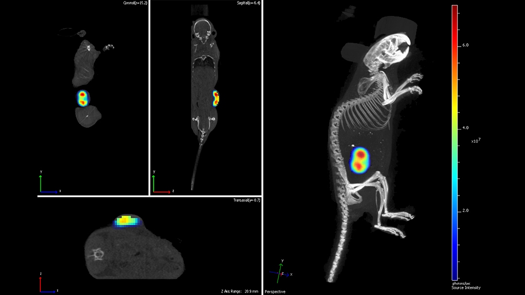 Bioluminescence tomography of tumor