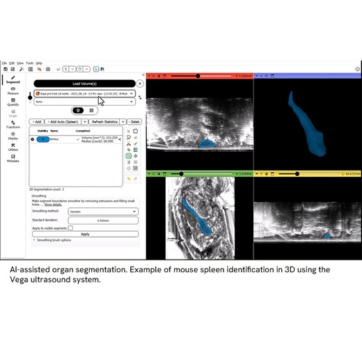 AI-assisted organ segmentation of mouse spleen using the Vega™ ultrasound system and Living Image™ Synergy AI software.