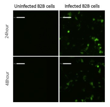 Viral infections-2