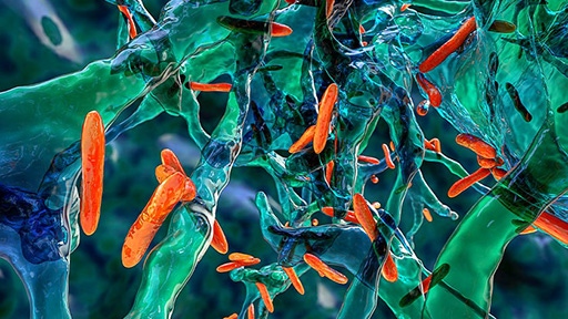 WHO TB report blog 2025