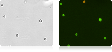 Bone Marrow Stem Cells – CD34+