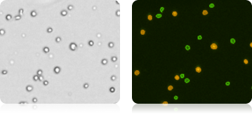 Isolated Mononuclear Cells Stained with AOPI