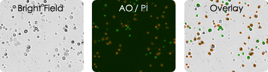 Human Melanoma Digest Sample Stained with AOPI