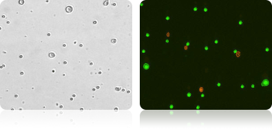 Tumor Cells with Lymphocytes