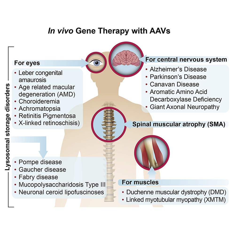 In vivo gene therapy with AAVs Mendell