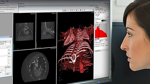 in-vivo-software-hero_512x288px.jpg