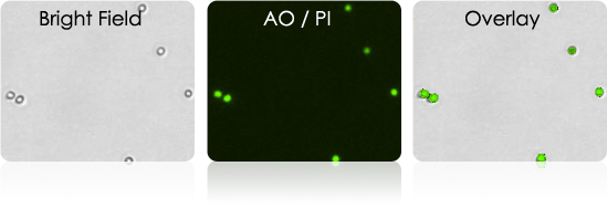 Isolated B-cells Stained with AOPI