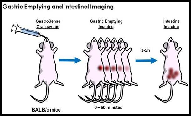 ivisense-gastrointestinal