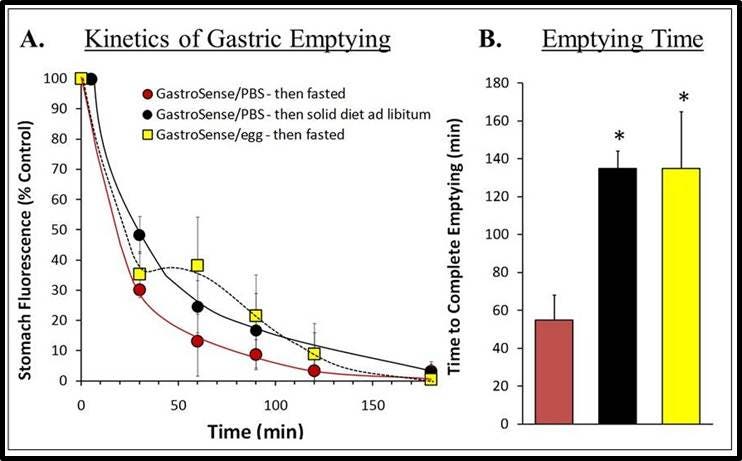 ivisense-gastrointestinal