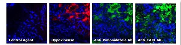 ivisense-hypoxia-ca-ix-fig6